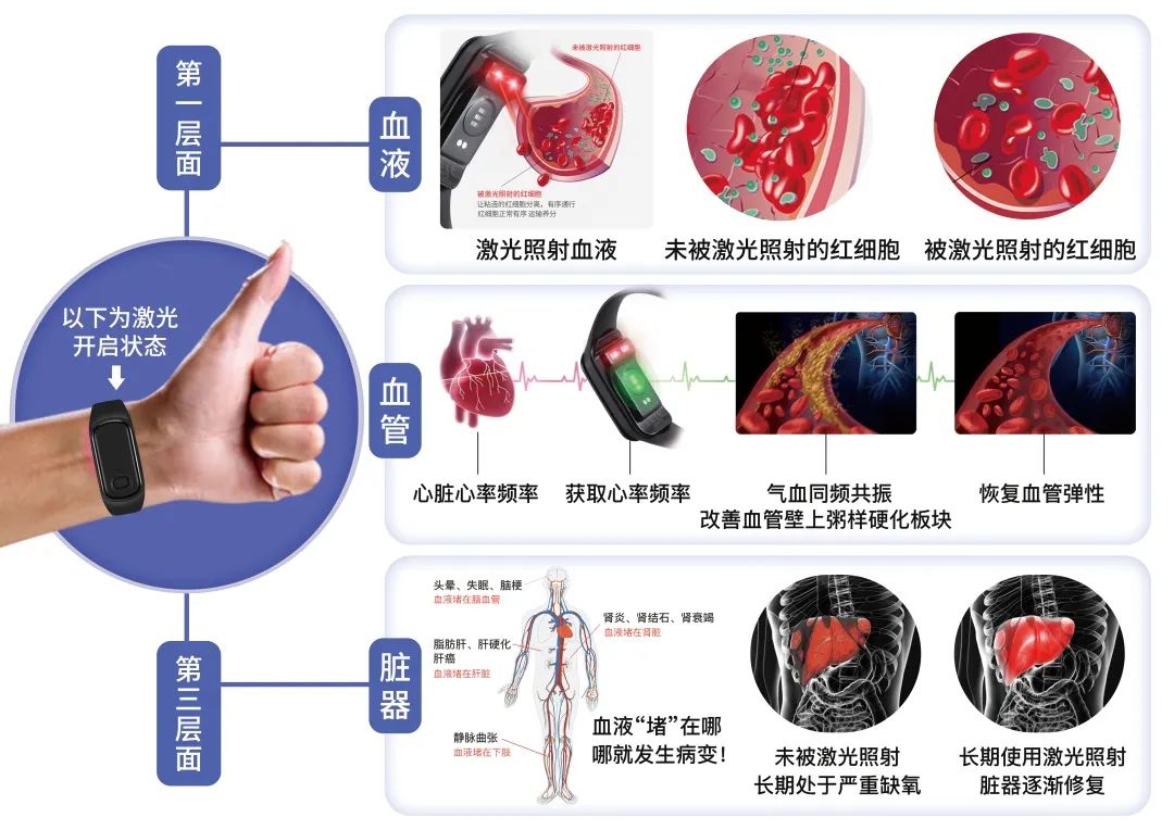 心脏血管堵塞最新开通技术，重塑心血管健康的希望之路