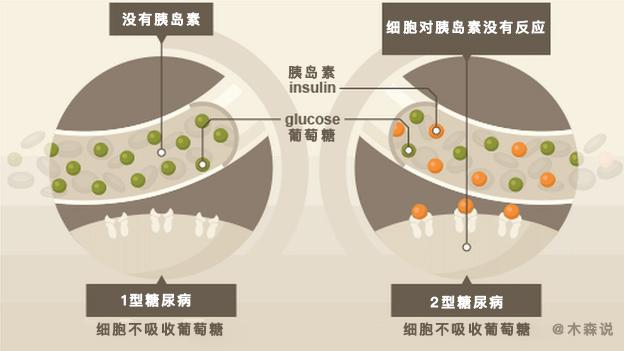 中国最新治疗下的Ⅰ型糖尿病管理，进展、挑战与探索